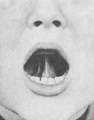 Жетілген әйелдің жалаңаш кискасы