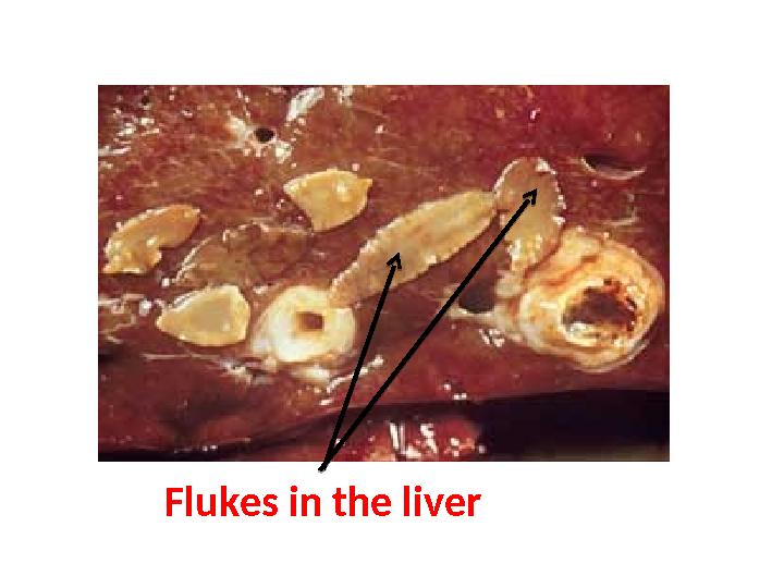 Flukes in the liver