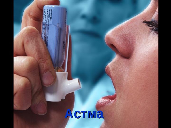 АстмаАстма