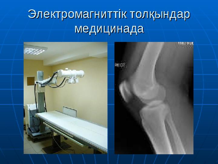 Электромагниттік толқындар Электромагниттік толқындар медицинадамедицинада