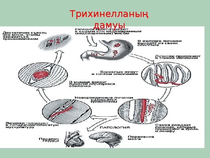 Трихинелланың дамуы