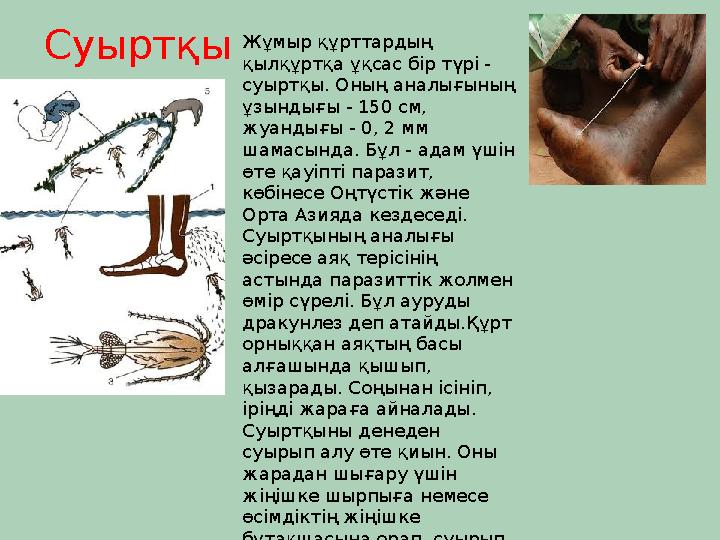 Суыртқы Жұмыр құрттардың қылқұртқа ұқсас бір түрі - суыртқы. Оның аналығының ұзындығы - 150 см, жуандығы - 0, 2 мм шамасын