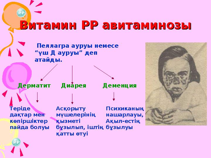 Витамин РР авитаминозыВитамин РР авитаминозы Пеллагра ауруы немесе “үш Д ауруы” деп атайды. Дерматит Диарея Деменция Терід