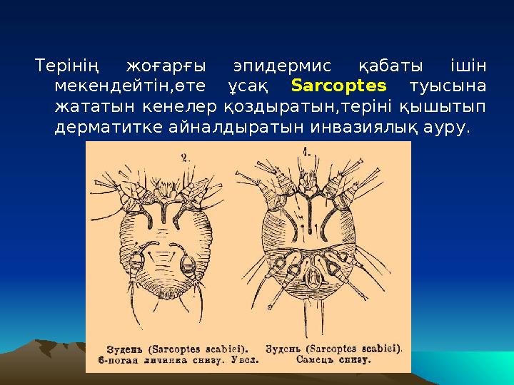 Терінің жоғарғы эпидермис қабаты ішін мекендейтін,өте ұсақ Sarcoptes туысына жататын кенелер қоздыратын,теріні қышы