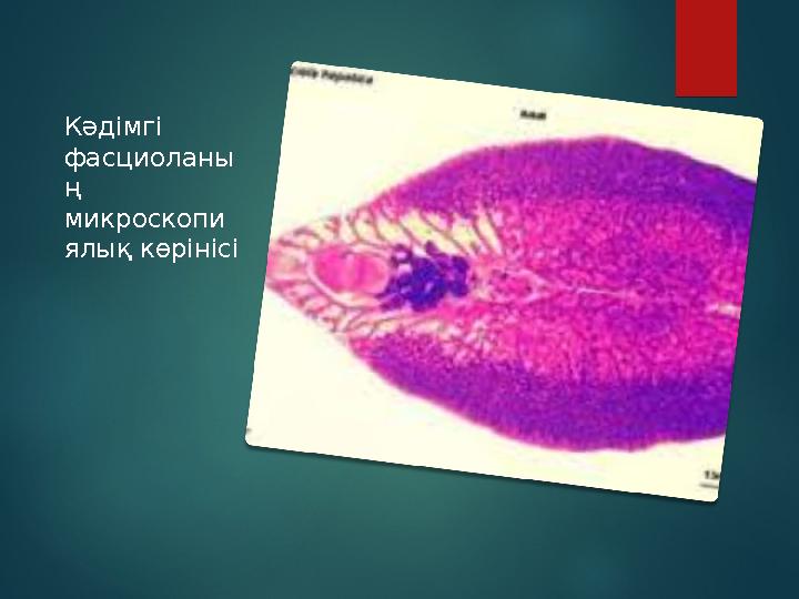 Кәдімгі фасциоланы ң микроскопи ялық көрінісі