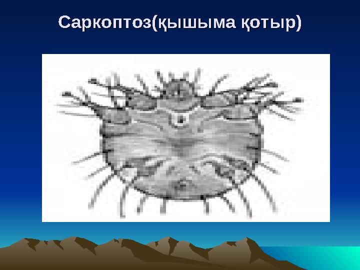 СС аркоптоз(қышыма қотыр)аркоптоз(қышыма қотыр)