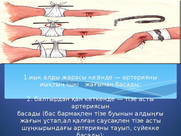 1.иык алды жарасы кезінде — артерияны иықтың ішкі жағынан басады; 2. балтырдан қан кеткенде — тізе асты артериясын басады (б