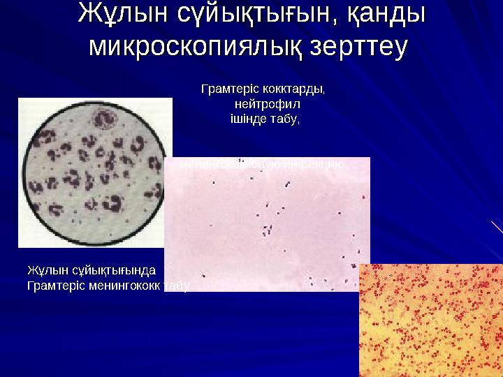 Диагноз (1)Диагноз (1) Диагностика основывается на клинических и Диагностика основывается на клинических и эпидемиологических д