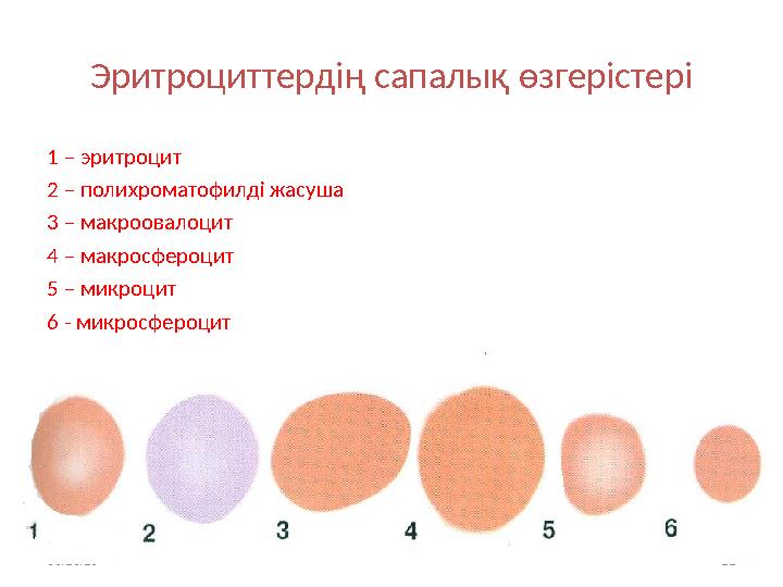 Эритроциттердің сапалық өзгерістері 1 – эритроцит 2 – полихроматофилді жасуша 3 – макроовалоцит 4 – макросфероцит 5 – микроцит 6