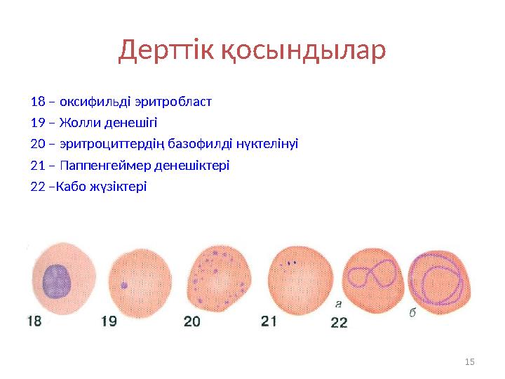 Дерттік қосындылар 18 – оксифильді эритробласт 19 – Жолли денешігі 20 – эритроциттердің базофилді нүктелінуі 21 – Паппенгеймер д