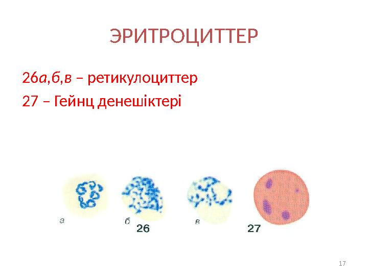 ЭРИТРОЦИТТЕР 26 а,б,в – ретикулоциттер 27 – Гейнц денешіктері 17