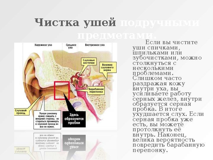Чистка ушей подручными предметами. Если вы чистите уши спичками, шпильками или зубочистками, можно столкнуться