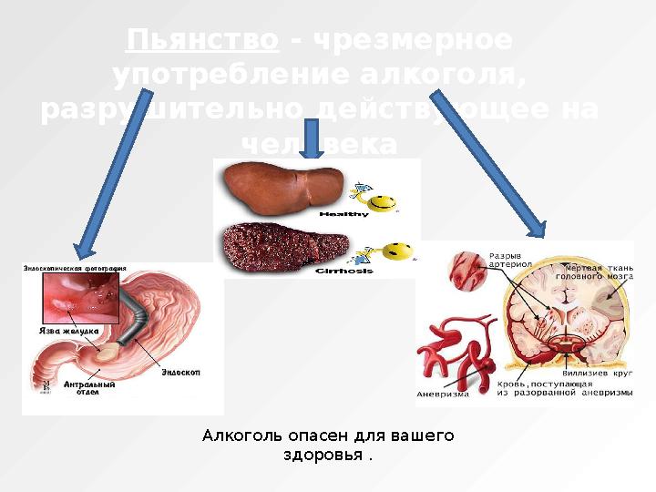 Пьянство - чрезмерное употребление алкоголя, разрушительно действующее на человека Алкоголь опасен для вашего здоровья .