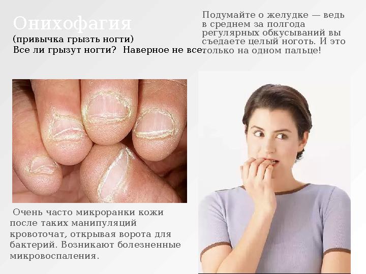 Онихофагия (привычка грызть ногти) Все ли грызут ногти? Наверное не все. Очень часто микроранки кожи после таких манипул