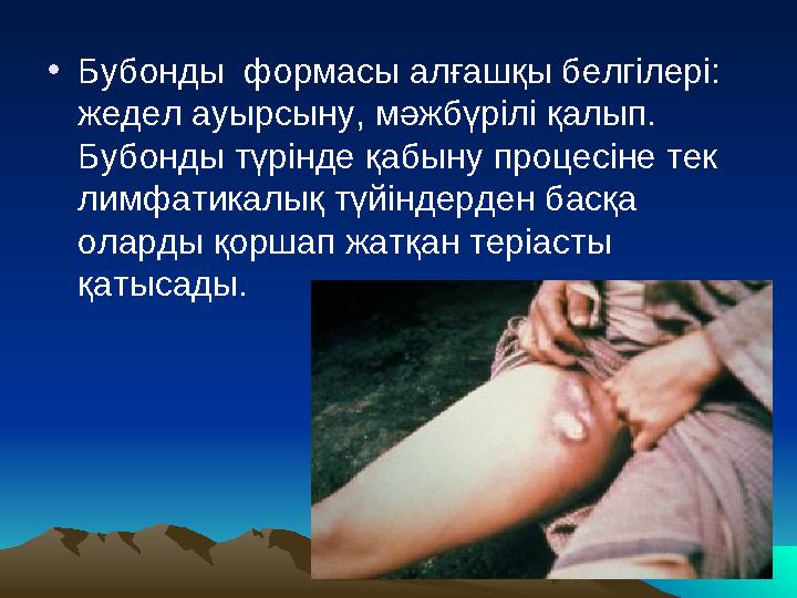 • Бубонды формасы алғашқы белгілері: жедел ауырсыну, мәжбүрілі қалып. Бубонды түрінде қабыну процесіне тек лимфатикалық түйі