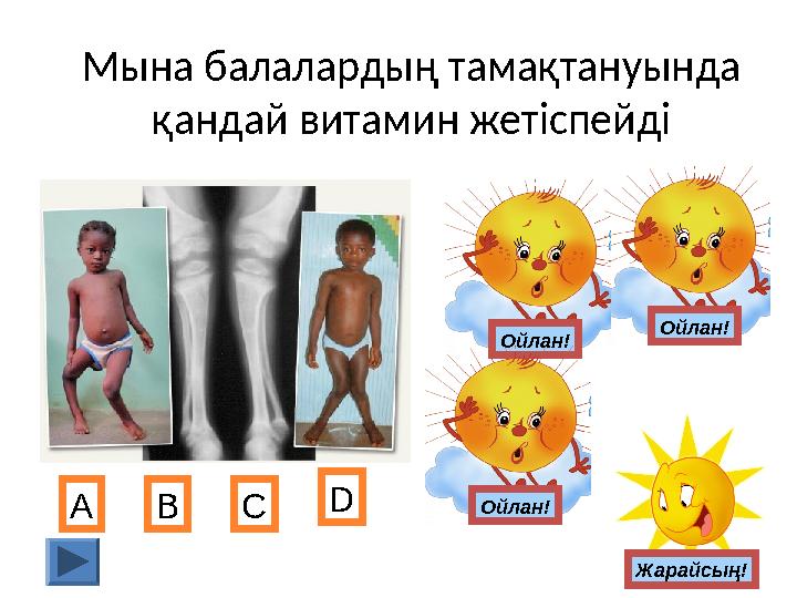 Мына балалардың тамақтануында қандай витамин жетіспейді А В С D Ойлан! Жарайсың!Ойлан! Ойлан!