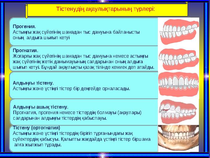 Прогения. Астыңғы жақ сүйегінің шамадан тыс дамуына байланысты оның алдыға шығып кетуі Тістенудің ақаулықтарының түрлері: Про