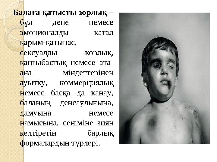 Кеудені сүтпен сорып жатқан бейне