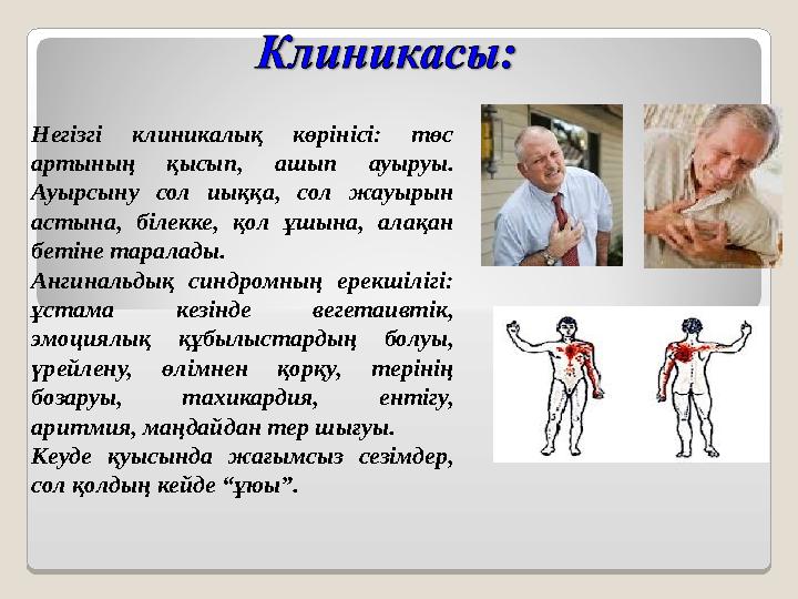 Негізгі клиникалық көрінісі: төс артының қысып, ашып ауыруы. Ауырсыну сол иыққа, сол жауырын астына, білекке, қол