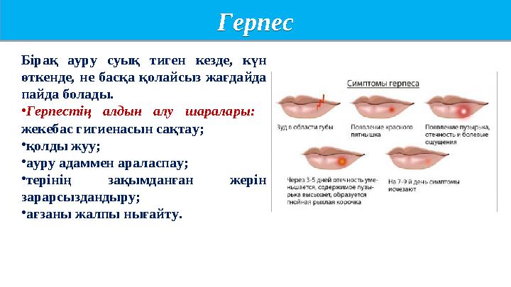 Герпес Герпес Бірақ ауру суық тиген кезде, күн өткенде, не басқа қолайсыз жағдайда пайда болады. •Герпестің алдын алу шарала