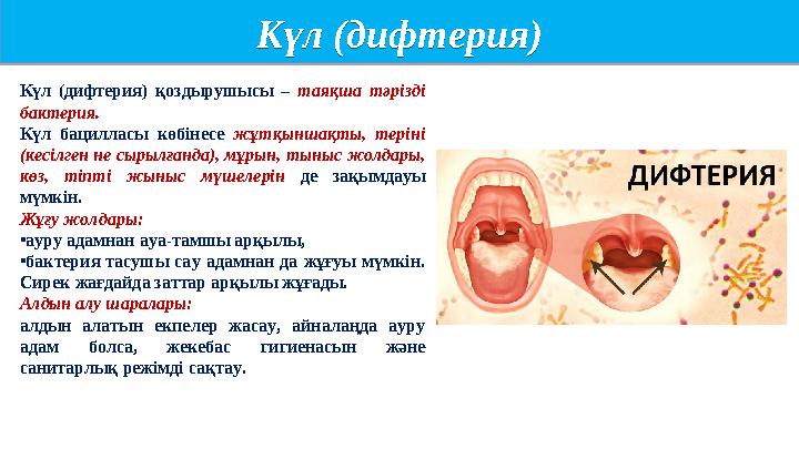 Күл (дифтерия) Күл (дифтерия) Күл (дифтерия) қоздырушысы – таяқша тәрізді бактерия. Күл бацилласы көбінесе жұтқыншақты, терін