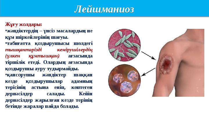 Лейшманиоз Лейшманиоз Жұғу жолдары: •жәндіктердің – үнсіз масалардың не құм шіркейлерінің шағуы. •табиғатта қоздырушысы шөлд