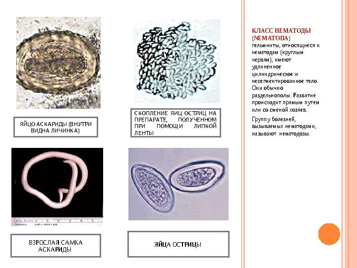 КЛАСС НЕМАТОДЫ (NEMATODA) гельминты, относящиеся к нематодам (круглым червям), имеют удлиненное цилиндрическое и несегмен