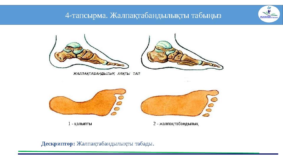 4-тапсырма. Жалпақтабандылықты табыңыз Дескриптор: Жалпақтабандылықты табады. Дескриптор: Бұлшық 1 - қалыпты 2 - жалпақтабанд