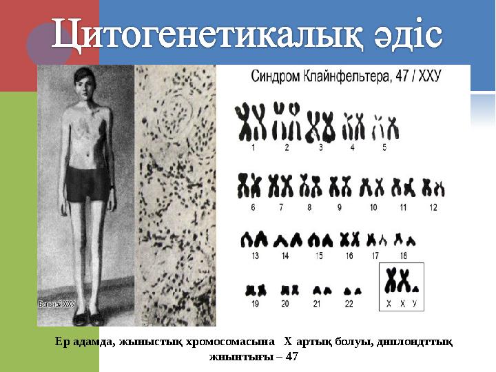 Ер адамда, жыныстық хромосомасына Х артық болуы, диплоидттық жиынтығы – 47