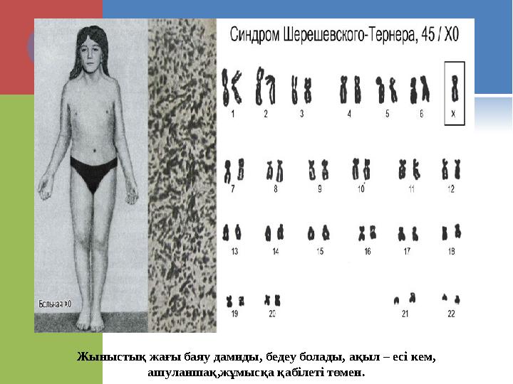 Жыныстық жағы баяу дамиды, бедеу болады, ақыл – есі кем, ашуланшақ,жұмысқа қабілеті төмен.