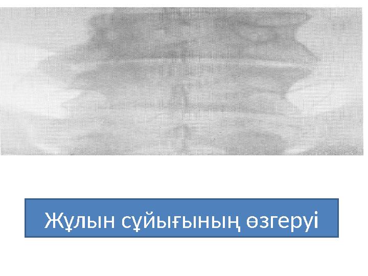 Жұлын сұйығының өзгеруі