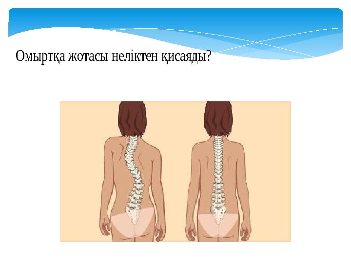 Омыртқа жотасы неліктен қисаяды?