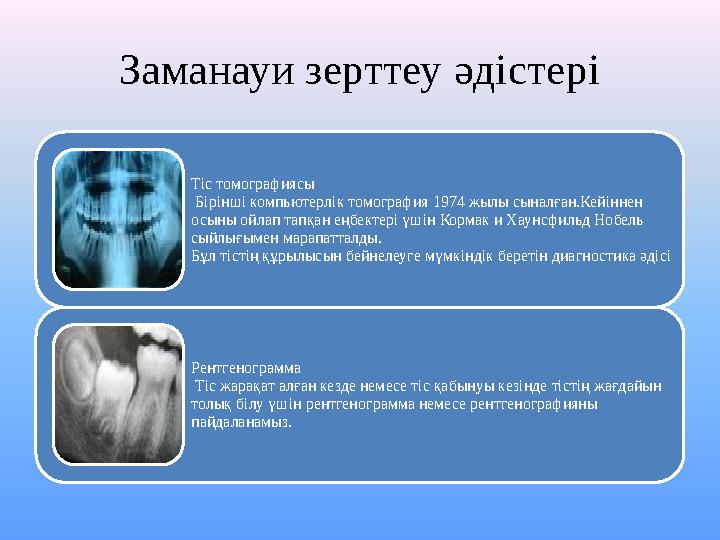 Заманауи зерттеу әдістері Тіс томографиясы Бірінші компьютерлік томография 1974 жылы сыналған.Кейіннен осыны ойлап тапқан еңб
