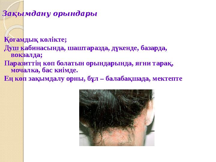 Зақымдану орындары Қоғамдық көлікте; Душ кабинасында, шаштаразда, дүкенде, базарда, вокзалда; Паразиттің көп болатын орын Зақымдану орындары Қоғамдық көлікте; Душ кабинасында, шаштаразда, дүкенде, базарда, вокзалда; Паразиттің көп болатын орын