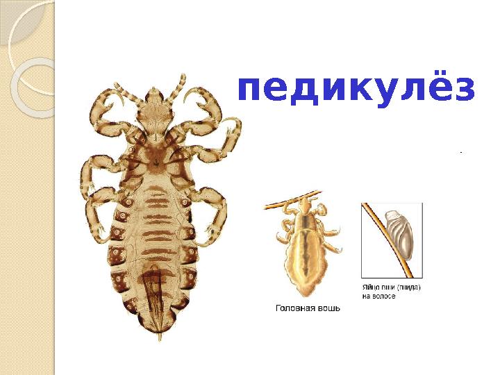 педикулёз педикулёз