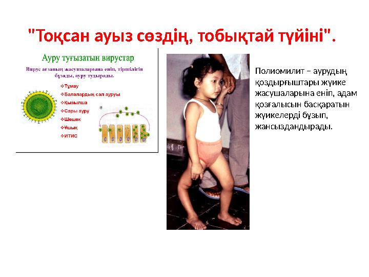 "Тоқсан ауыз сөздің, тобықтай түйіні". Полиомилит – аурудың қоздырғыштары жүике жасушаларына еніп, адам қозғалысын басқараты