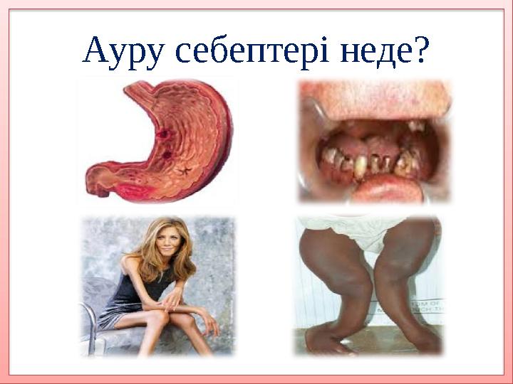 Ауру себептері неде?