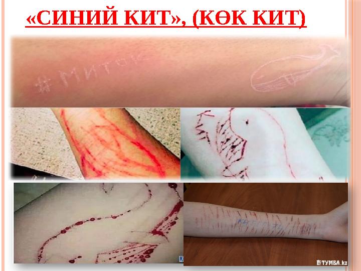 «СИНИЙ КИТ», (КӨК КИТ)