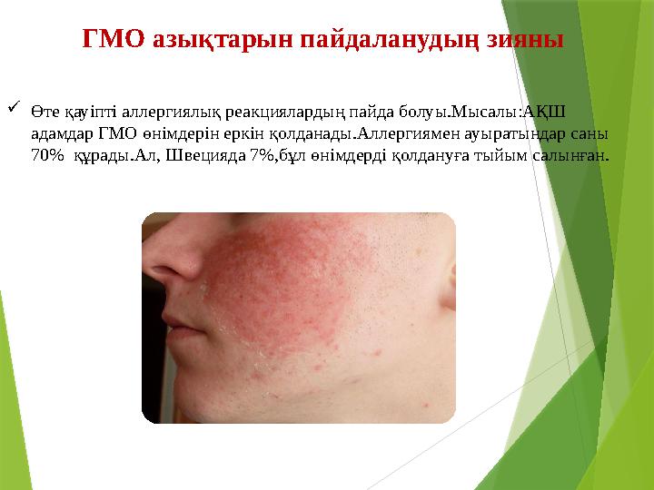 Өте қауіпті аллергиялық реакциялардың пайда болуы.Мысалы:АҚШ адамдар ГМО өнімдерін еркін қолданады.Аллергиямен