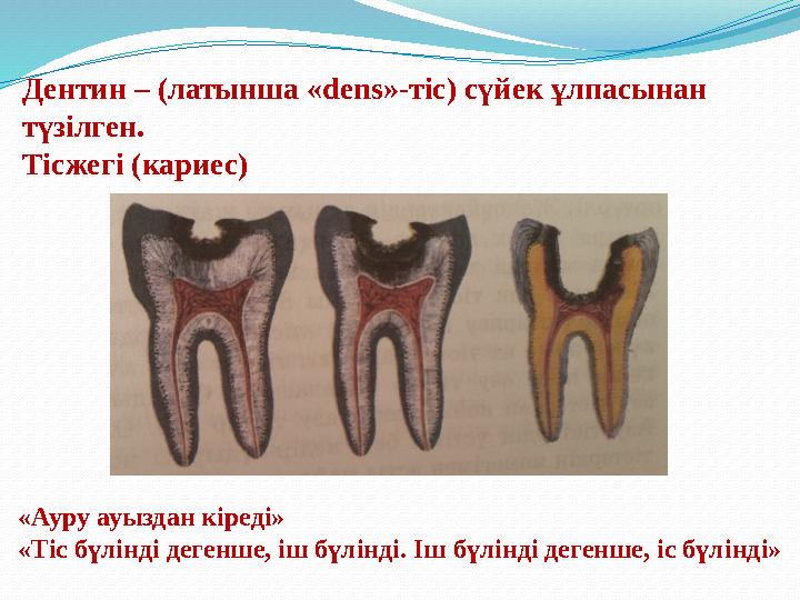 Дентин – (латынша «dens»-тіс) сүйек ұлпасынан түзілген. Тісжегі (кариес) «Ауру ауыздан кіреді» «Тіс бүлінді дегенше, іш бүлінді