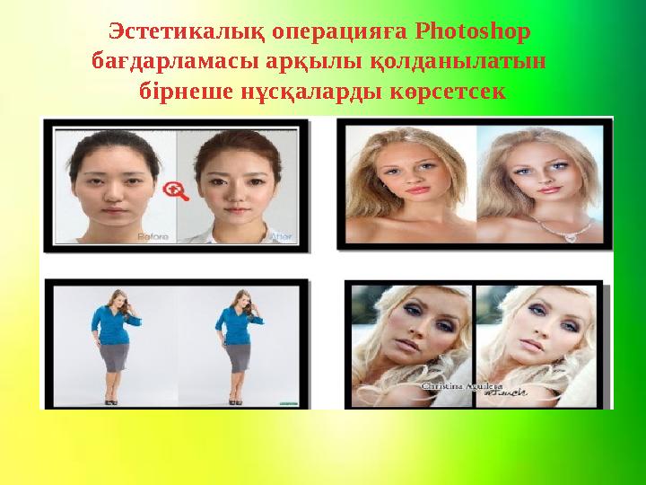 Эстетикалық операцияға Photoshop бағдарламасы арқылы қолданылатын бірнеше нұсқаларды көрсетсек