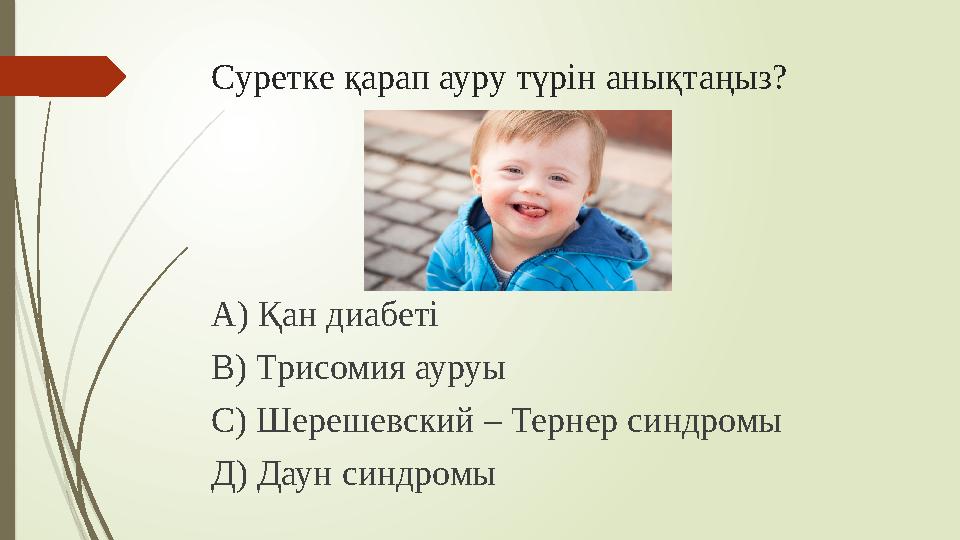 Суретке қарап ауру түрін анықтаңыз? А) Қан диабеті В) Трисомия ауруы С) Шерешевский – Тернер синдромы Д) Даун синдромы