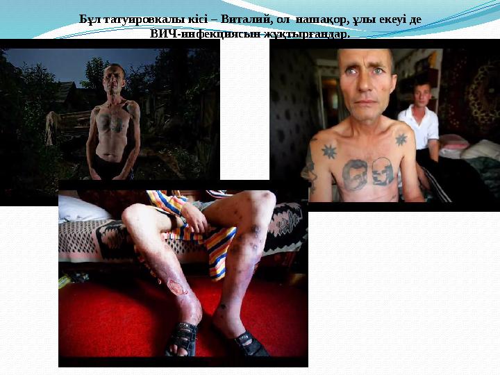 Бұл татуировкалы кісі – Виталий, ол нашақор, ұлы екеуі де ВИЧ - инфекциясын жұқтырғандар.