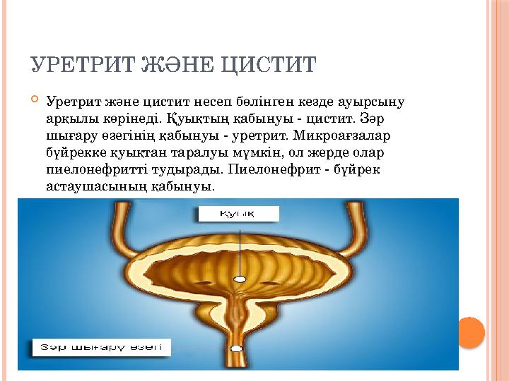 УРЕТРИТ ЖӘНЕ ЦИСТИТ  Уретрит және цистит несеп бөлінген кезде ауырсыну арқылы көрінеді. Қуықтың қабынуы - цистит. Зәр шығару