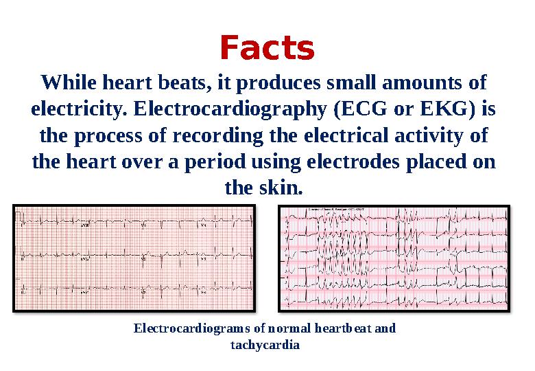 Facts While heart beats, it produces small amounts of electricity. Electrocardiography (ECG or EKG) is the process of recordin