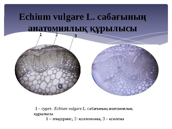 1 2 3 1 – сурет. Есһіит vиlgаrе L. сабағының анатомиялық құрылысы 1 – эпидермис; 2- колленхима; 3 – ксилема Е