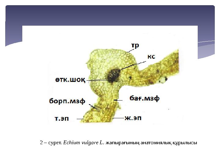 2 – сурет. Есһіит vиlgаrе L. жапырағының анатомиялық құрылысы