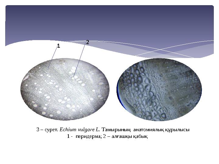 1 2 3 – сурет. Есһіит vиlgаrе L. Тамырының анатомиялық құрылысы 1 - перидерма; 2 – алғашқы қабық