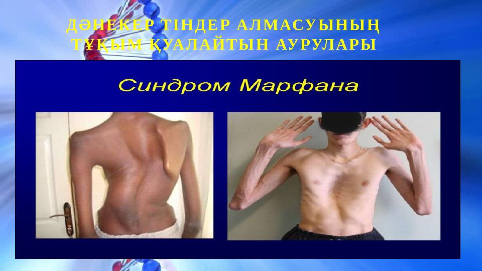 ДӘНЕКЕР ТІНДЕР АЛМАСУЫНЫҢ ТҰҚЫМ ҚУАЛАЙТЫН АУРУЛАРЫ