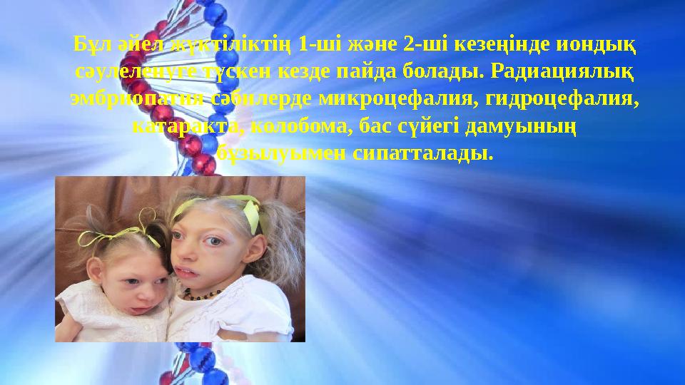 Бұл әйел жүктіліктің 1-ші және 2-ші кезеңінде иондық сәулеленуге түскен кезде пайда болады. Радиациялық эмбриопатия сәбилерд